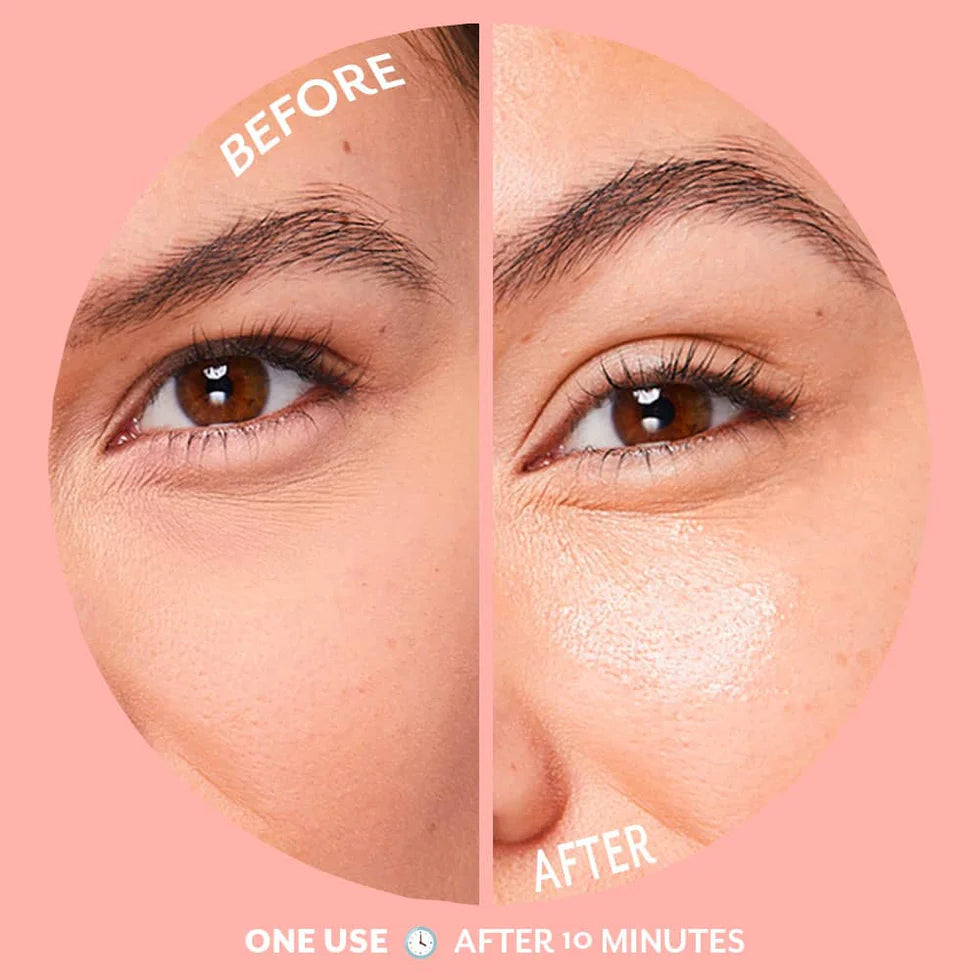 Bubbly Eye Gels Patchology